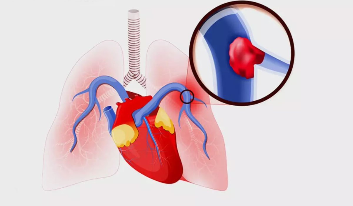 علل ایجاد درد در سمت راست قفسه سینه