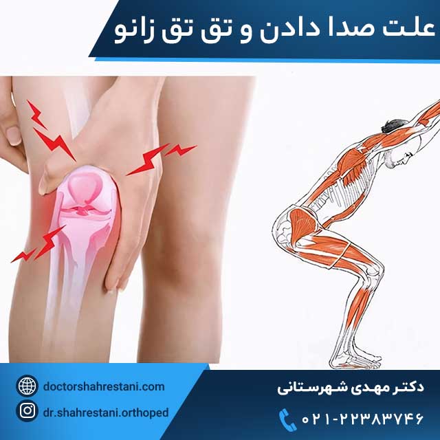 علت صدا دادن و تق تق زانو