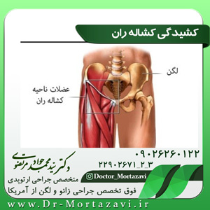 عکس کشیدگی-کشاله-ران