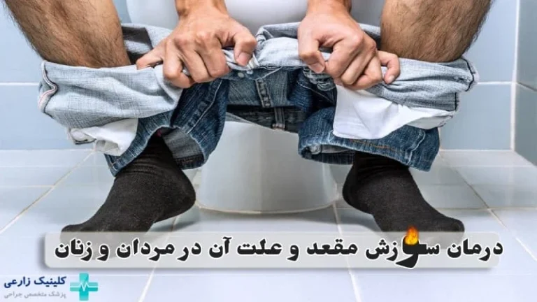 علت سوزش مدفوع و اسهال