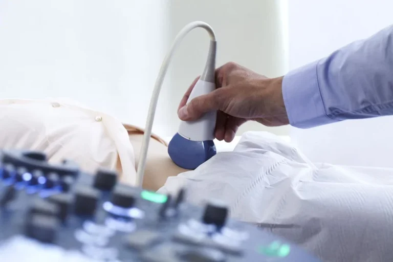 معنی Lateral Ventricle در سونوگرافی؛ راهنمای جامع اندازه طبیعی و بررسی بزرگی بطن