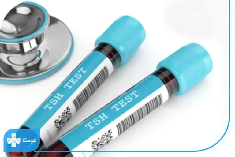Tsh در آزمایش خون چیست