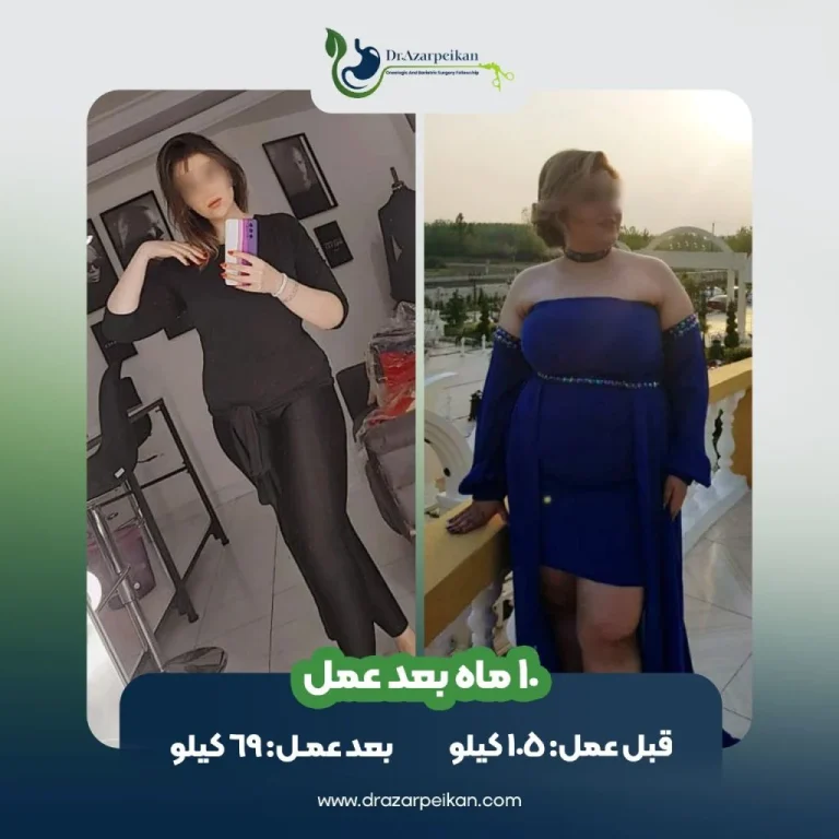 عمل زیبایی واژن قبل و بعد؛ راهنمای جامع جراحی، مراقبت های تخصصی و نتایج واقعی (بروزرسانی 1405)