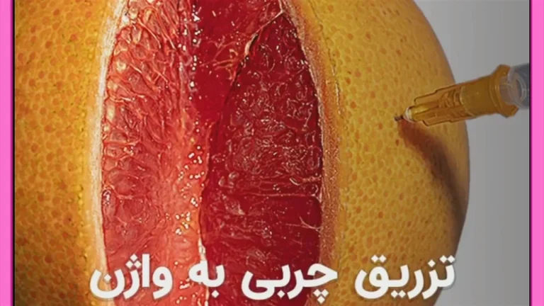لابیاپلاستی و تزریق ژل به واژن: بررسی کامل عکس قبل و بعد، هزینه و مراقبت ها