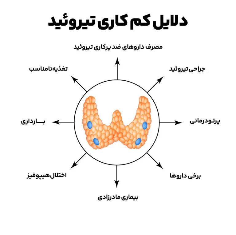 کم کاری تیروئید و عفونت واژن