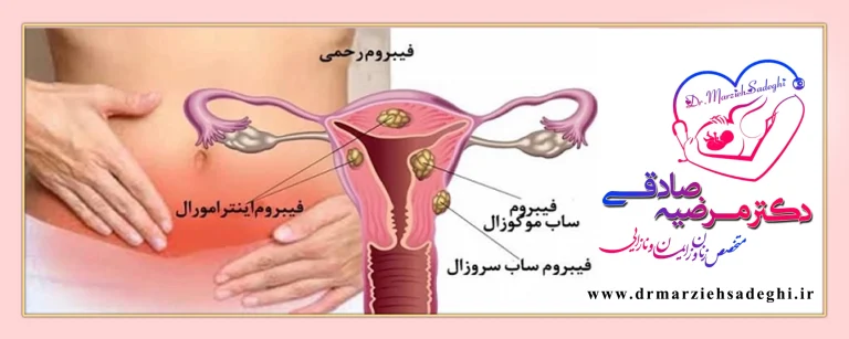 کرایو در بارداری: راهنمای جامع ایمنی، عوارض و مراقبت های درمان سرما درمانی