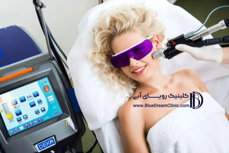 تفاوت لیزر الکس و دایود چیست؟ راهنمای جامع انتخاب بهترین دستگاه لیزر مو های زائد در سال 1405