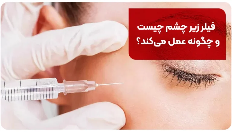 فیلر زیر چشم چیست و چگونه عمل می کند؟ راهنمای کامل مزایا و عوارض