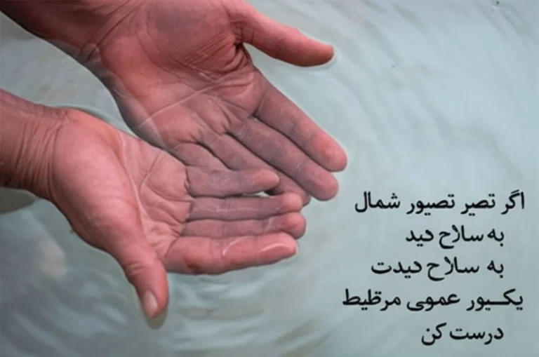 کراتودرمی آکواژنیک؛ بررسی کامل علت، علائم و جدیدترین روش های درمان