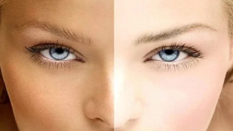 برای سفید شدن پوست سبزه چه کنیم؟