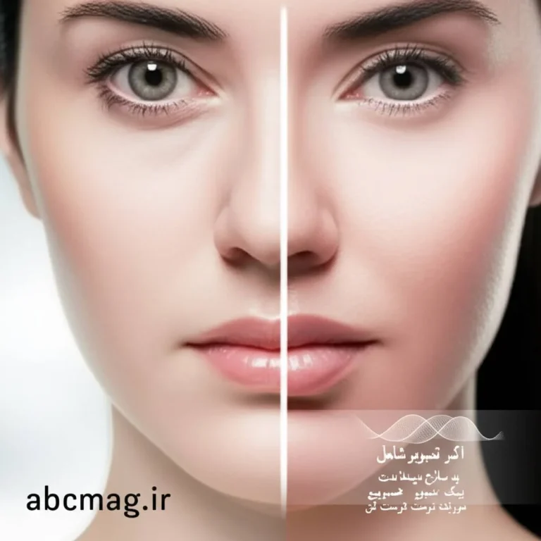 هایفوتراپی چیست؟