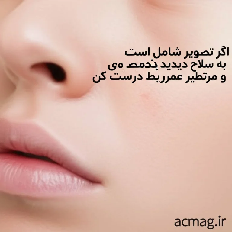 عوارض میکرونیدلینگ: راهنمای جامع پیشگیری و مراقبت های بعد از درمان