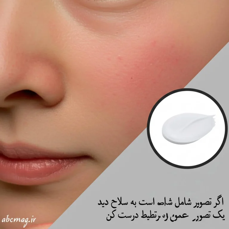 معرفی بهترین کرم ضد قرمزی پوست صورت و راهنمای جامع درمان التهاب