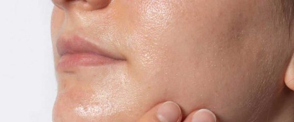 معرفی پکیج کنترل چربی پوست سیلکر و مزایای آن