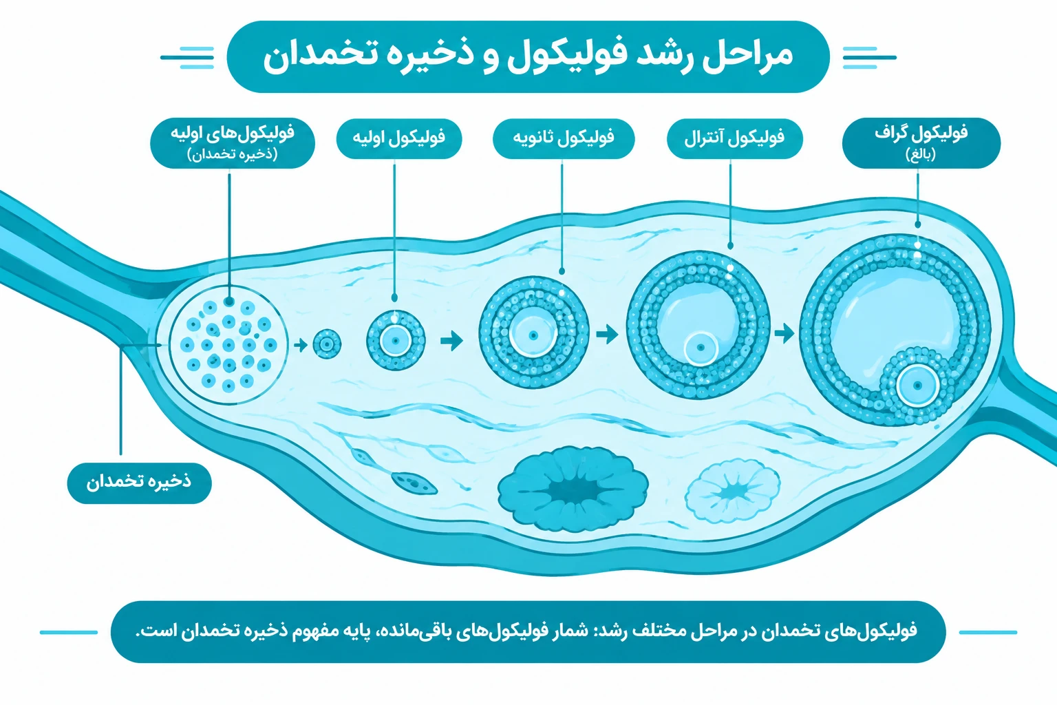 نمایش شماتیک تخمدان و فولیکول ها در مراحل مختلف رشد برای توضیح مفهوم ذخیره تخمدان